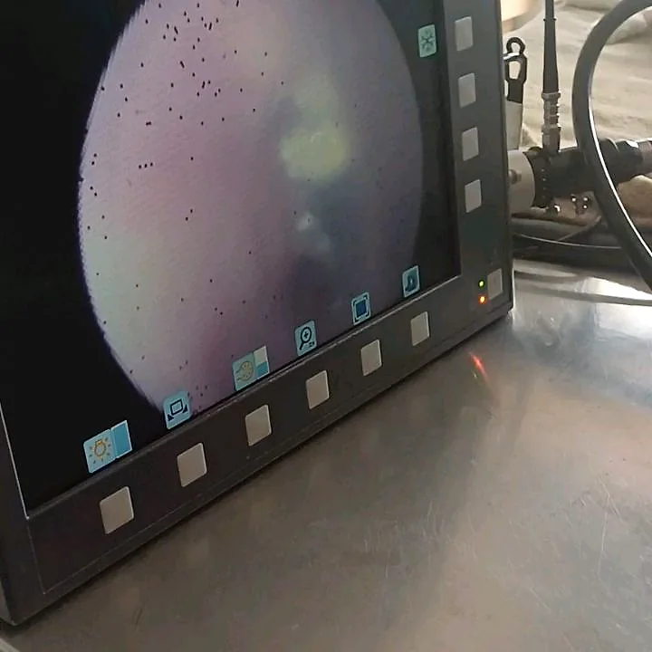 Pantalla del endoscopio durante la extracción de un cuerpo extraño del estómago de Lilo