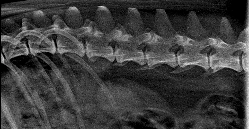 Radiografía lateral de la columna de un paciente
