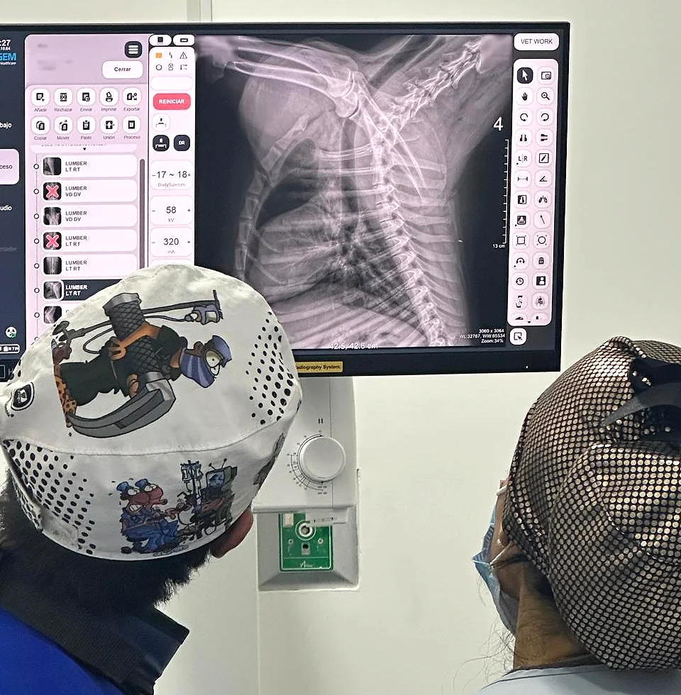 Radiografía de tórax en la pantalla del equipo de rayos X digital, durante su revisión