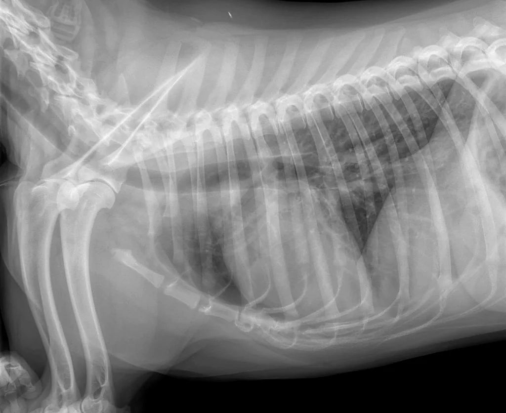 Radiografía lateral de tórax de un paciente